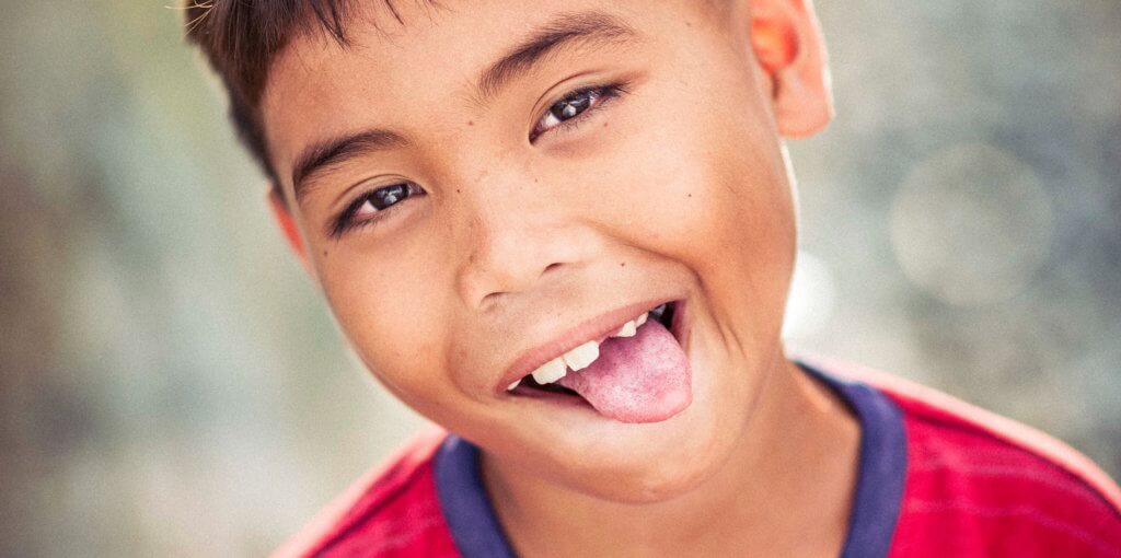 Lingual Frenectomy | Holt Dental Care - Dentist in West Jordan - Dr. Joshua C. Holt