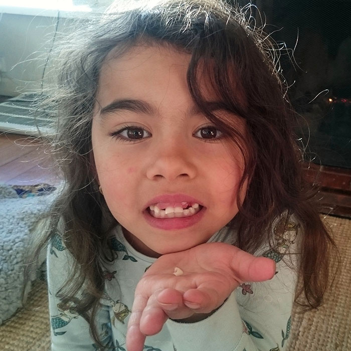 first-loose-tooth-2022_700.jpg