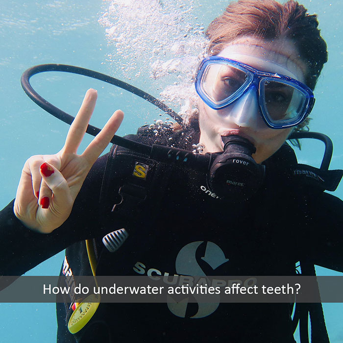 How Do Swimming and Diving Affect Teeth? | Holt Dental Care - Dentist in West Jordan - Dr. Joshua C. Holt