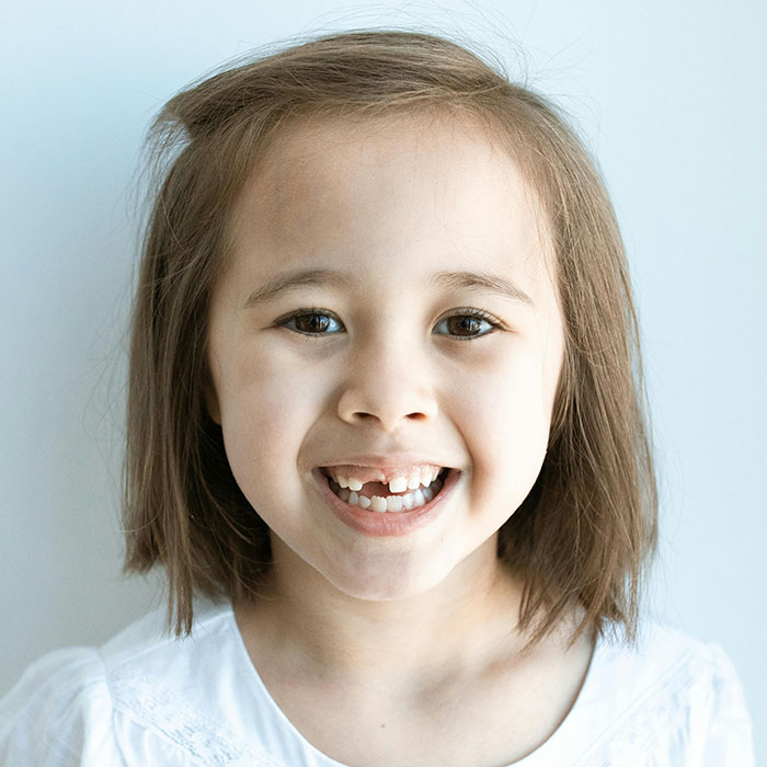 What Do Different Cultures Do With Baby Teeth? | Holt Dental Care - Dentist in West Jordan - Dr. Joshua C. Holt